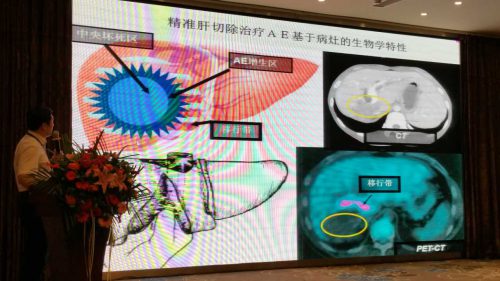 李海涛在2017年全国包虫病防控技术研讨会上作报告